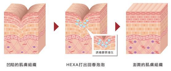激光治療小知識 什麼是皮秒？
